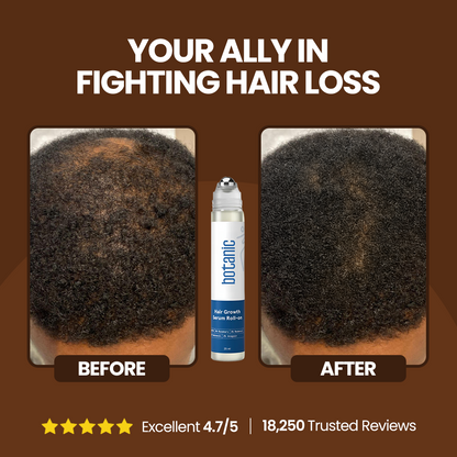 Patented Rosemary Hair Growth Roll-On Serum