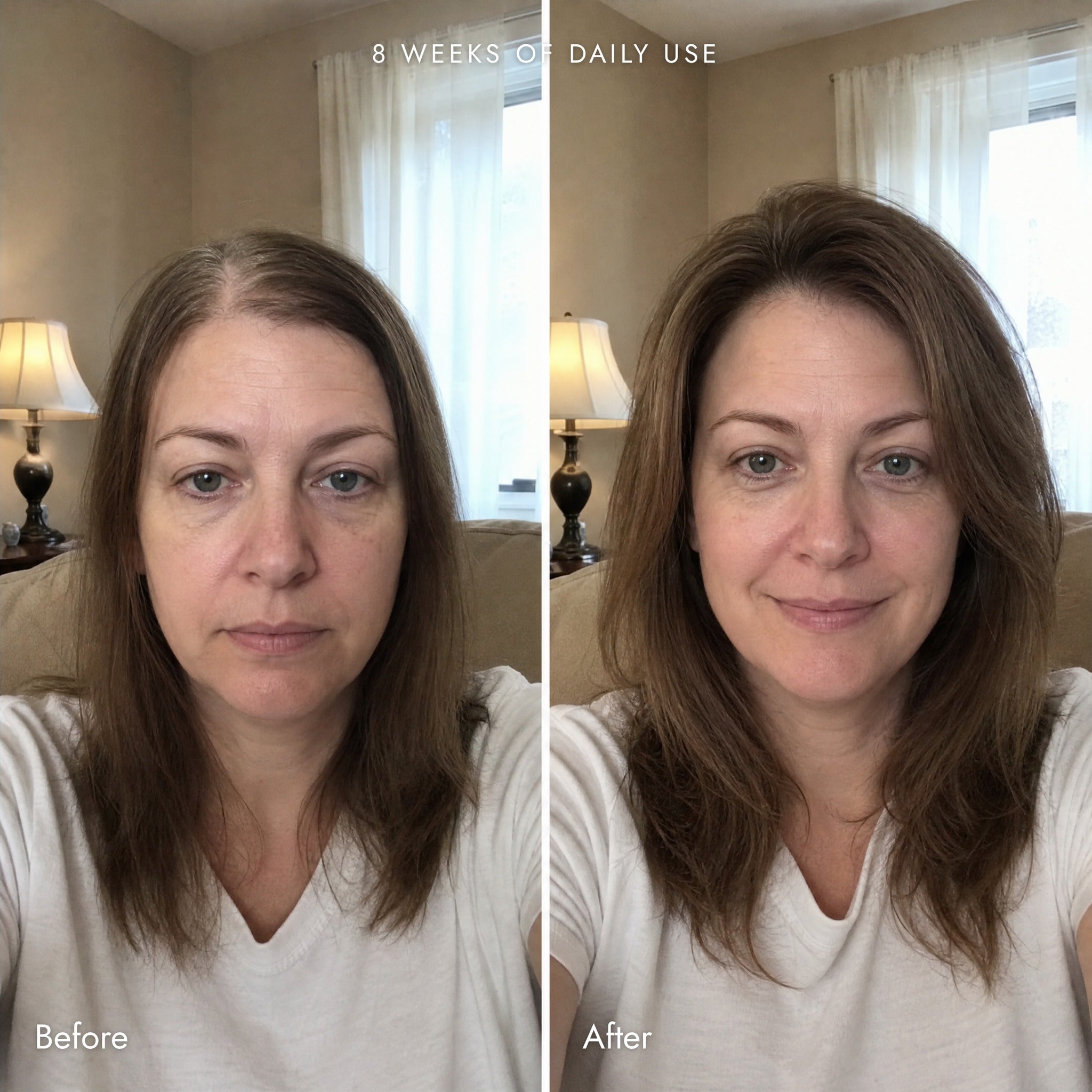 Before and after, 1